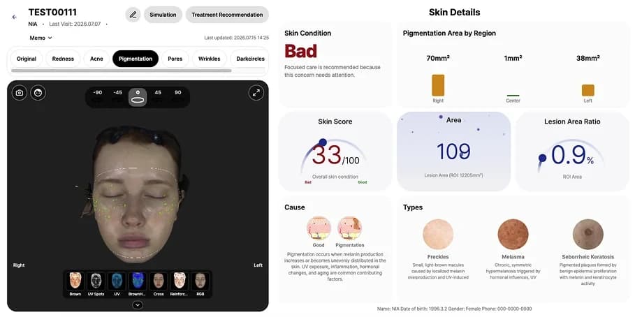 LUSKIN X pigmentation detail by facial region