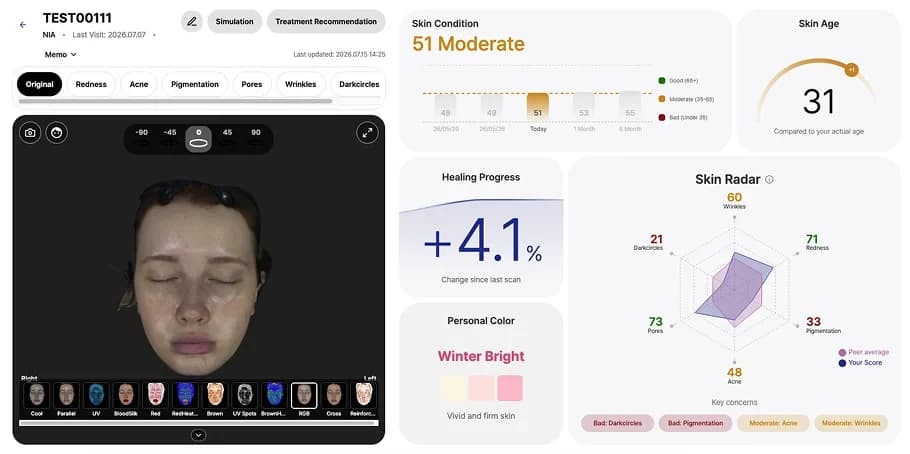 LUSKIN X report with the 3D face, skin condition, skin age and key concerns