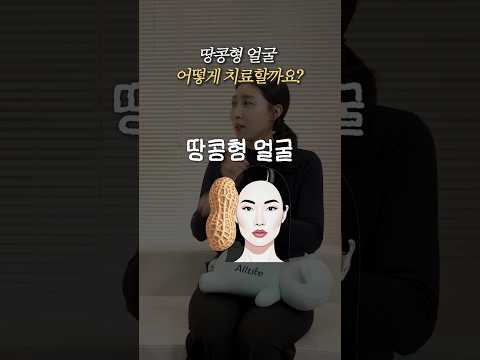 Center-Face Lifting for a Peanut-Shaped Face
