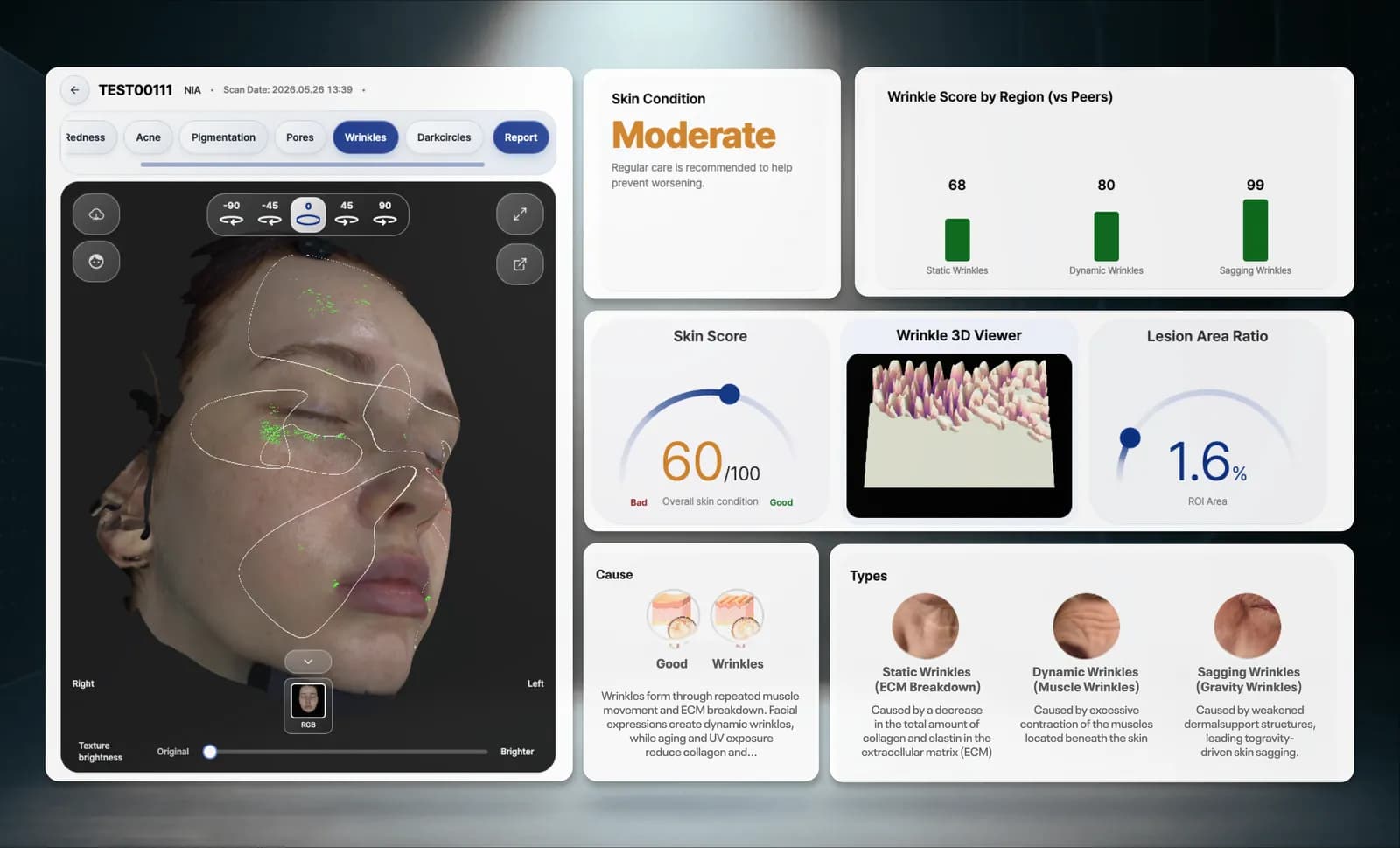 Lulu@ 3D skin analysis dashboard showing a facial scan and skin scores