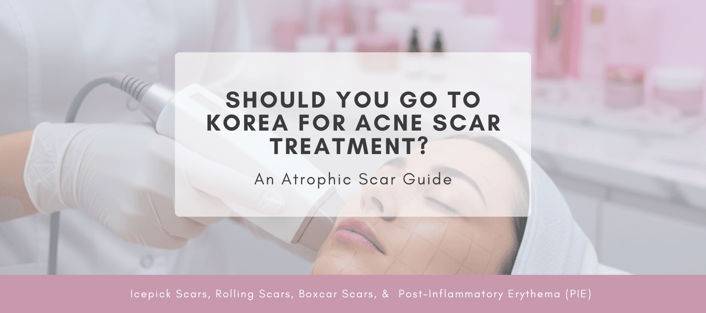 Should You Go to Korea for Acne Scar Treatment? An Atrophic Scar Guide