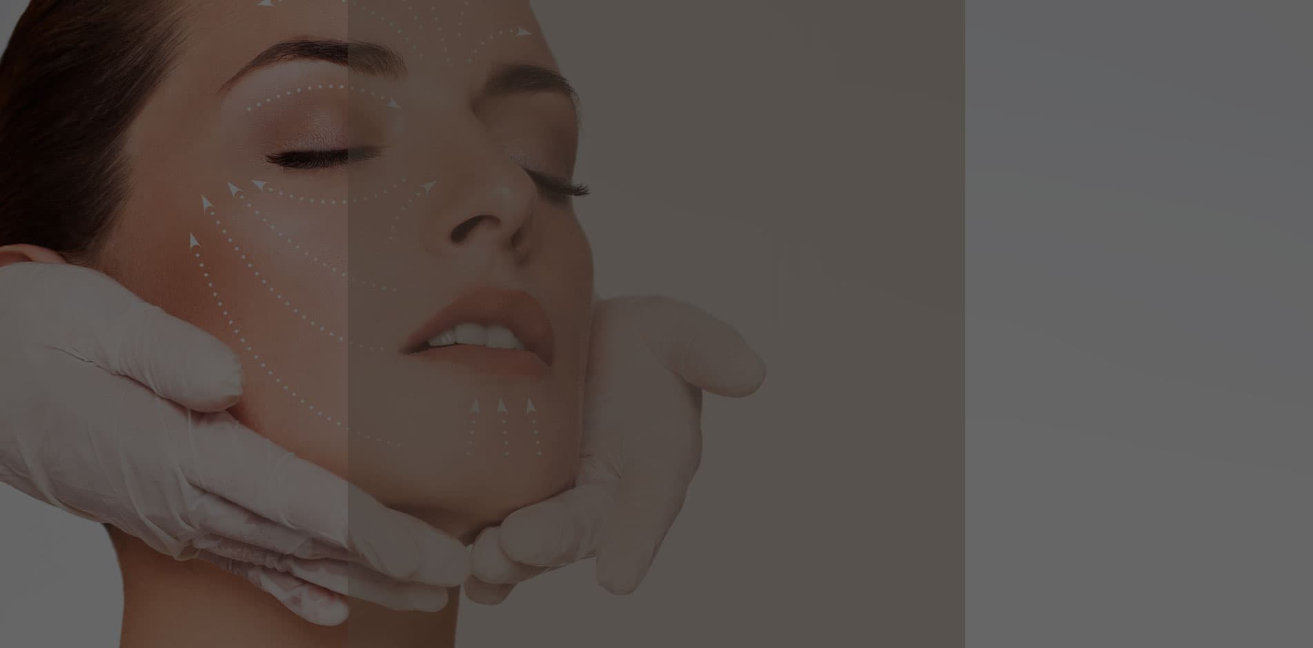 Botox (Xeomin)
