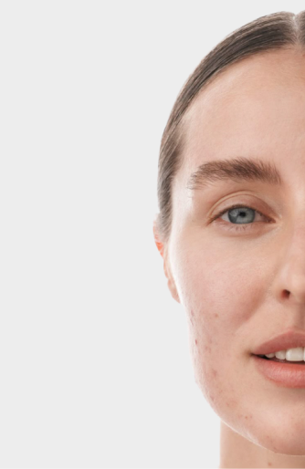 Before treatment example
