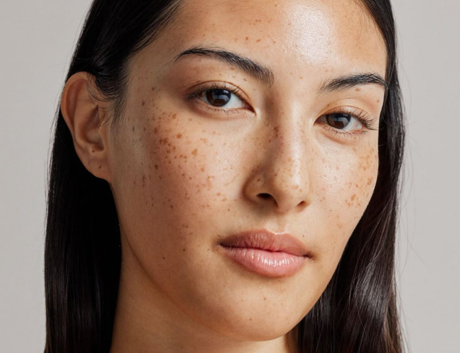 Science-backed skin analysis example